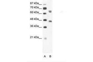 Image no. 1 for anti-RRN3 RNA Polymerase I Transcription Factor (RRN3) (AA 331-380) antibody (ABIN202852) (RRN3 anticorps  (AA 331-380))