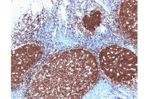 Pax-5 (clone 24) staining on human tonsil. (PAX5 anticorps  (AA 151-306))
