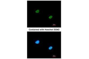 ICC/IF Image Immunofluorescence analysis of paraformaldehyde-fixed A431, using RBBP5, antibody at 1:200 dilution. (RBBP5 anticorps  (Center))