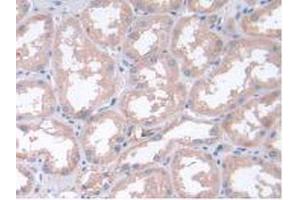 IHC-P analysis of Human Kidney Tissue, with DAB staining. (LIF anticorps  (AA 2-201))