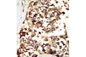 Image no. 2 for anti-Protein Kinase D2 (PKD2) (C-Term) antibody (ABIN360330) (PKD2 anticorps  (C-Term))