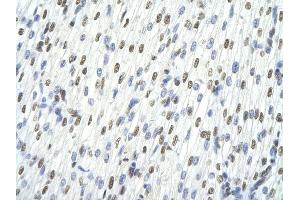 Rabbit Anti-TARDBP antibody         Paraffin Embedded Tissue:  Human Heart    cell Cellular Data:  cardiac cell    Antibody Concentration:  4. (TARDBP anticorps  (C-Term))