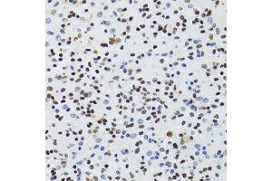 Immunohistochemistry of paraffin-embedded mouse brain using NFKB2 Antibody.