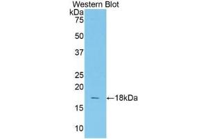 Western blot analysis of the recombinant protein. (TCF20 anticorps  (AA 1656-1792))