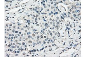 Image no. 1 for anti-Synovial Sarcoma, X Breakpoint 2 (SSX2) antibody (ABIN1501161) (SSX2 anticorps)