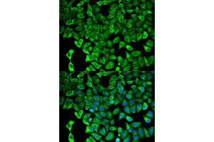 Immunofluorescence (IF) image for anti-Proteasome (Prosome, Macropain) 26S Subunit, Non-ATPase, 2 (PSMD2) antibody (ABIN1874389) (PSMD2 anticorps)