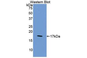 Western Blotting (WB) image for anti-Coagulation Factor VIII (F8) (AA 2253-2346) antibody (ABIN1175158) (Factor VIII anticorps  (AA 2253-2346))