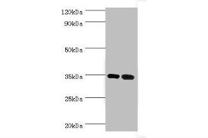 Western blot All lanes: MAGEA6 antibody at 7 μg/mL Lane 1: Rat brain tissue Lane 2: Rat gonad tissue Secondary Goat polyclonal to rabbit IgG at 1/10000 dilution Predicted band size: 35 kDa Observed band size: 35 kDa (MAGEA6 anticorps  (AA 75-314))