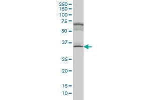 MYOZ1 monoclonal antibody (M05A), clone 1E8.