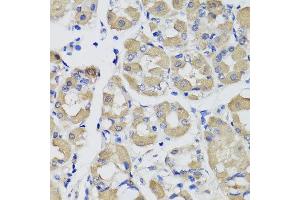 Immunohistochemistry of paraffin-embedded human gastric using PSPH antibody at dilution of 1:100 (x40 lens). (PSPH anticorps)