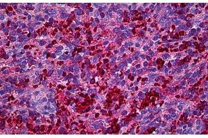 Human Spleen: Formalin-Fixed, Paraffin-Embedded (FFPE) (XCL1 anticorps  (AA 22-114))