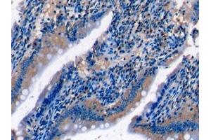 Detection of C5a in Rat Small intestine Tissue using Monoclonal Antibody to Complement Component 5a (C5a)