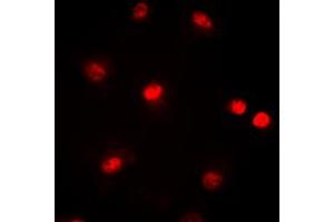Immunofluorescent analysis of CBP staining in HeLa cells. (CBP anticorps  (Center))