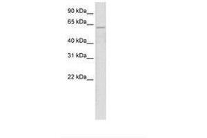 Image no. 1 for anti-Zinc Finger Protein 426 (ZNF426) (AA 70-119) antibody (ABIN202755) (ZNF426 anticorps  (AA 70-119))
