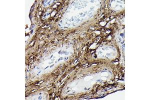 Immunohistochemistry of paraffin-embedded human placenta using Collagen I/COL1 Rabbit pAb (ABIN6134502, ABIN6138839, ABIN6138840 and ABIN6221469) at dilution of 1:100 (40x lens).