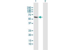 Western Blot analysis of GTF2E1 expression in transfected 293T cell line by GTF2E1 MaxPab polyclonal antibody.