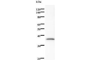 Western Blotting (WB) image for anti-SUMO1 Activating Enzyme Subunit 1 (SAE1) antibody (ABIN931206) (SAE1 anticorps)