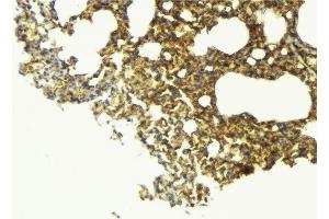 ABIN6276864 at 1/100 staining Mouse lung tissue by IHC-P.