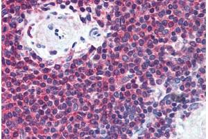 Human Spleen (formalin-fixed, paraffin-embedded) stained with MIF antibody ABIN305887 at 5 ug/ml followed by biotinylated anti-mouse IgG secondary antibody ABIN481714, alkaline phosphatase-streptavidin and chromogen. (MIF anticorps  (AA 1-114))