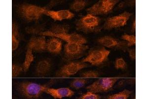 Immunofluorescence analysis of C6 cells using IFITM3 Polyclonal Antibody at dilution of 1:100. (IFITM3 anticorps)