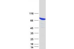 Validation with Western Blot