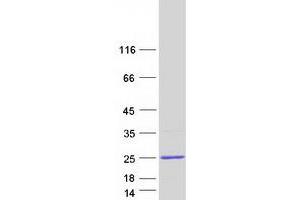 Validation with Western Blot