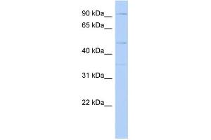 WB Suggested Anti-DPY19L2 Antibody Titration: 0. (DPY19L2 anticorps  (Middle Region))