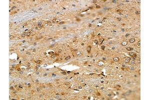 ABIN6257883 and ABIN6275262 at 1/100 staining Rat brain tissue by IHC-P. (MYOM2 anticorps  (Internal Region))