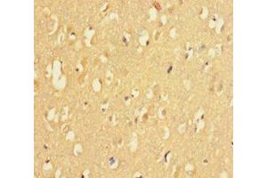 Immunohistochemistry of paraffin-embedded human brain tissue using ABIN7158695 at dilution of 1:100 (KDM4A anticorps  (AA 127-364))