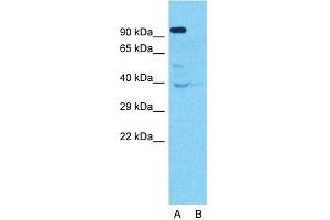 Host:  Rabbit  Target Name:  PEO1  Sample Type:  Hela  Lane A:  Primary Antibody  Lane B:  Primary Antibody + Blocking Peptide  Primary Antibody Concentration:  1ug/ml  Peptide Concentration:  5. (C10orf2 anticorps  (Middle Region))