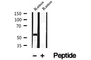 Western blot analysis of extracts of Ramos cells, using Phospho-CD79A (Tyr182) Antibody. (CD79a anticorps  (pTyr182))