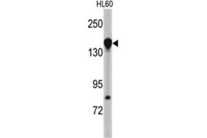Western blot analysis of NUP155 antibody (N-term) in HL60 cell line lysates (35ug/lane). (NUP155 anticorps  (N-Term))