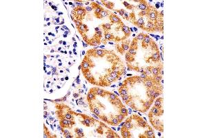 (ABIN6244025 and ABIN6578318) staining TST in human kidney tissue sections by Immunohistochemistry (IHC-P - paraformaldehyde-fixed, paraffin-embedded sections).