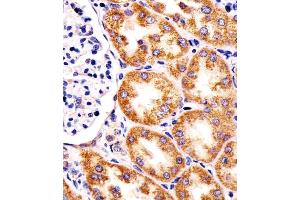 (ABIN6244025 and ABIN6578318) staining TST in human kidney tissue sections by Immunohistochemistry (IHC-P - paraformaldehyde-fixed, paraffin-embedded sections). (TST anticorps  (AA 170-203))