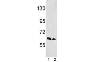 Western blot analysis of EphA3 antibody and 1) NCI-H460, 2) 293 lysate.