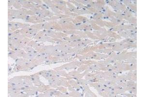 Detection of CCK in Rat Heart Tissue using Polyclonal Antibody to Cholecystokinin (CCK) (Cholecystokinin anticorps  (AA 1-115))