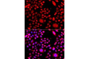 Immunofluorescence analysis of A549 cell using RAC3 antibody. (RAC3 anticorps)