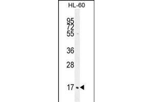 C1QC Antibody (Center) (ABIN655873 and ABIN2845277) western blot analysis in HL-60 cell line lysates (35 μg/lane). (C1QC anticorps  (AA 93-120))