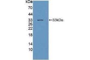 Detection of Recombinant gp130, Mouse using Polyclonal Antibody to Glycoprotein 130 (gp130) (CD130/gp130 anticorps  (AA 238-500))