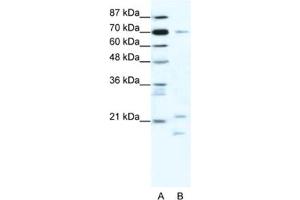 Western Blotting (WB) image for anti-Basic Transcription Factor 3 (BTF3) antibody (ABIN2461626) (BTF3 anticorps)