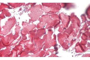 Detection of COL1a1 in Human Dermis of Skin Tissue using Polyclonal Antibody to Collagen Type I Alpha 1 (COL1a1)