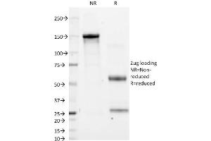 SDS-PAGE Analysis Purified CD11a Mouse Monoclonal Antibody (CRIS-3). (ITGAL anticorps)