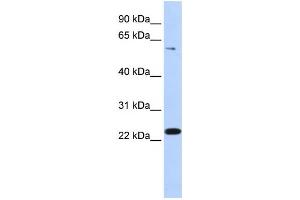 Western Blotting (WB) image for anti-Zinc Finger Protein 460 (ZNF460) antibody (ABIN2459428) (ZNF460 anticorps)