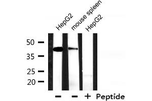 Western blot analysis of extracts from HepG2, mouse spleen , using Keratin 18 Antibody.