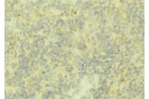 ABIN6276791 at 1/100 staining Mouse liver tissue by IHC-P.