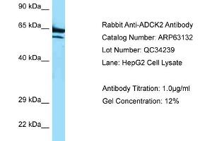 Western Blotting (WB) image for anti-AarF Domain Containing Kinase 2 (ADCK2) (C-Term) antibody (ABIN970062) (ADCK2 anticorps  (C-Term))