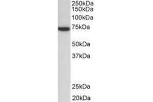 Image no. 1 for anti-zeta-Chain (TCR) Associated Protein Kinase 70kDa (ZAP70) (AA 289-303) antibody (ABIN1105090) (ZAP70 anticorps  (AA 289-303))