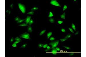 Image no. 2 for anti-Formiminotransferase Cyclodeaminase (FTCD) (AA 440-542) antibody (ABIN599156) (FTCD anticorps  (AA 440-542))
