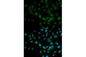Immunofluorescence analysis of MCF7 cell using MAPK7 antibody. (MAPK7 anticorps  (AA 1-310))