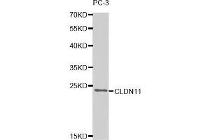Western Blotting (WB) image for anti-Claudin 11 (CLDN11) antibody (ABIN1871890) (Claudin 11 anticorps)